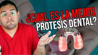 ¿NECESITAS PRÓTESIS DENTAL 👅 ¡Deberías ver este vídeo Ft Dentalk [upl. by Aihsik]