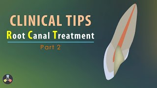 Root Canal Treatment  Clinical tips  Part 2 [upl. by Heisel884]