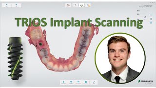 3shape TRIOS  Straumann Implant Scanning Workflow [upl. by Wylde60]