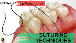 SUTURING TECHNIQUESDEMONSTRATION [upl. by Miguelita]