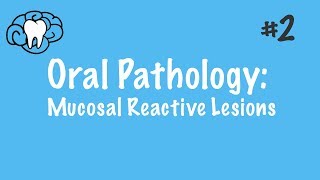 Oral Pathology  Mucosal Malignant Lesions  INBDE ADAT [upl. by Lipscomb679]