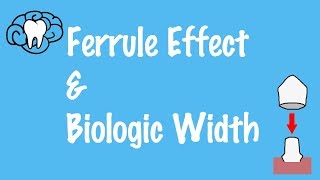 Ferrule Effect and Biologic Width [upl. by Ettedranreb]