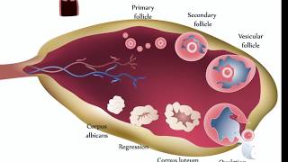 Ovarian Cysts [upl. by Asyl368]