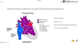 Tricuspid Atresia [upl. by Jehanna]