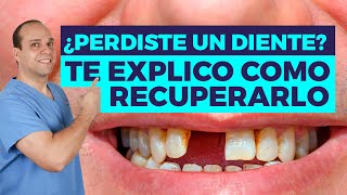 PERDÍ un DIENTE 😥 ¿Qúe Hago 31 SOLUCIONES Posibles 😉 [upl. by Baryram]