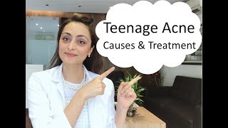 Teenage Acne causes amp treatment [upl. by Aidin]